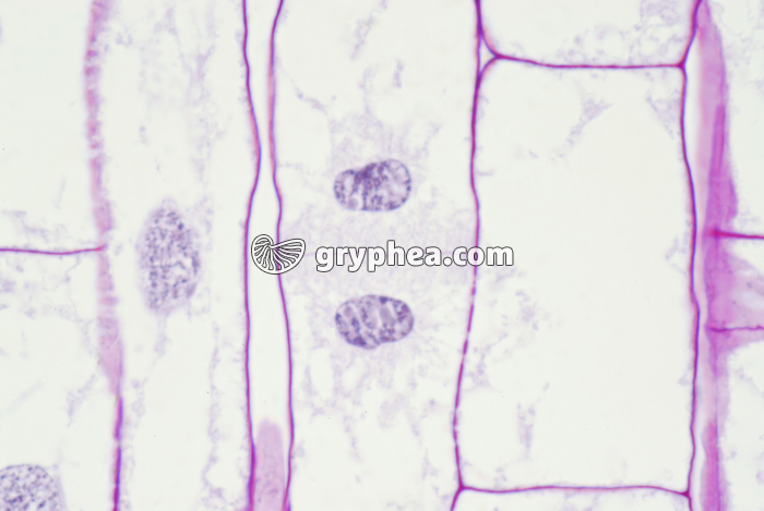 Mitose dans une racine de Blé (télophase - détail) x400  - gryphea.com